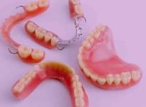 دندان مصنوعی با پذیرش بیمه و ضمانت (دندانسازی) در شیپور-عکس کوچک