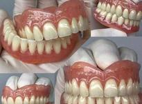 لابراتوار دندانسازی ساخت دندان مصنوعی باضمانت در شیپور-عکس کوچک