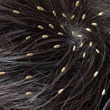 پاکسازی مو از رشک بادستگاه دریک جلسه در شیپور