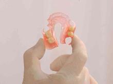 پروتز دندانسازی ساخت دندان مصنوعی ژله ای و نایتگارد تضمینی در شیپور