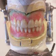خدمات لابراتوار دندان سازی مصنوعی متحرک ساخت تعمیر در محل
