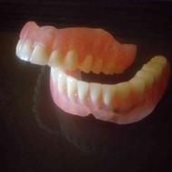 قالبگیری ساخت دندان مصنوعی پروتز دنچر در محل شما (سیار) منزل