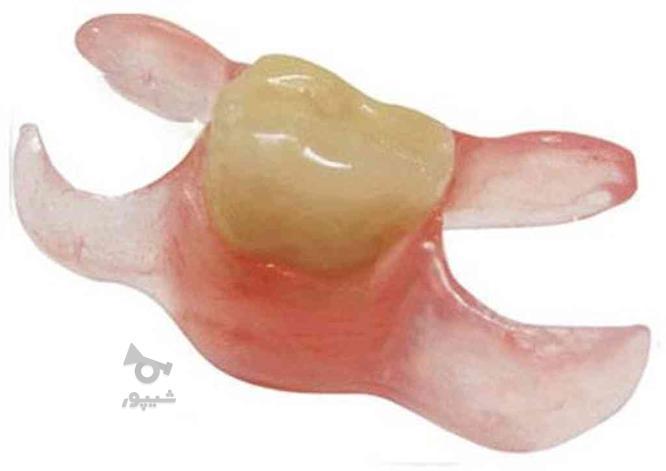 دندانسازی دندان مصنوعی بیمه