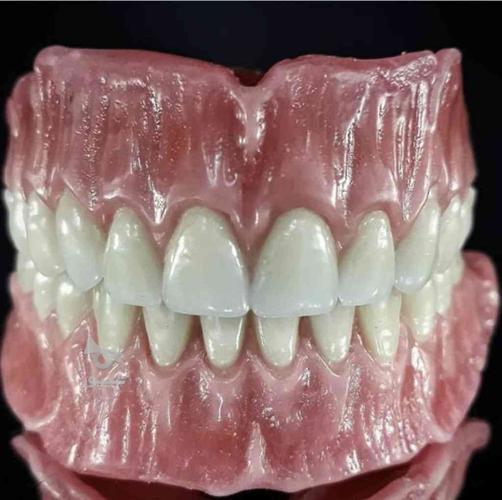 دندانسازی _ دندان مصنوعی _ پروتز متحرک _ دندانپزشکی