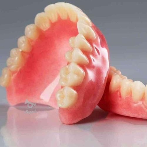 دندانسازی متحرک با کیفیت