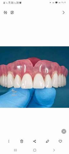 دندان سازی