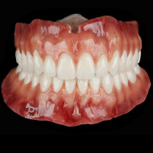 دندان سازی