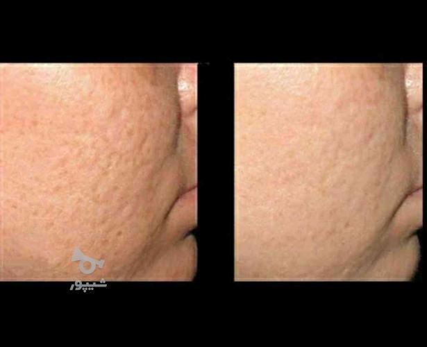 آموزش خدمات مراقبت پوستی فیشیال پاکسازی پوست