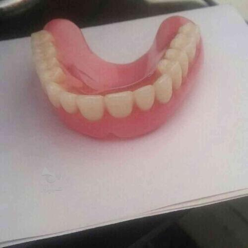 دندانسازی متحرک
