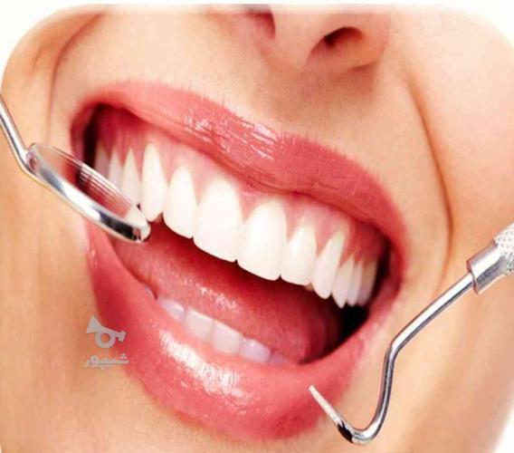 تخفیف ویژه دندانپزشکی