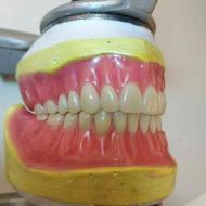 پروتز دندانسازی ساخت دندان مصنوعی لثه نرم