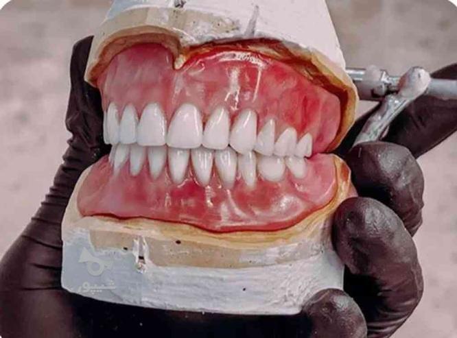 دندانسازی دندان مصنوعی