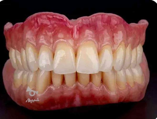 دندانسازی دندان مصنوعی