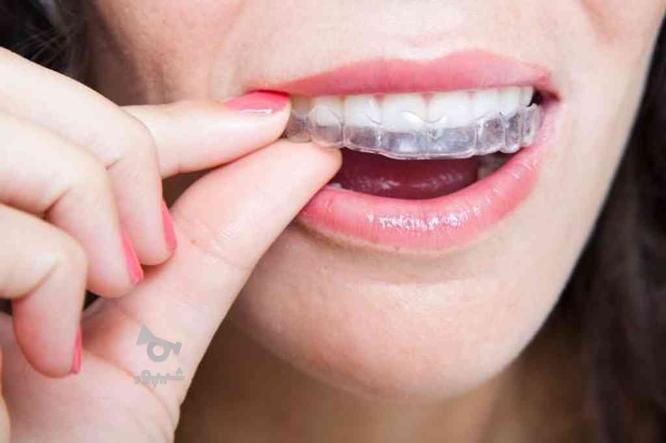 دندان سازی با پذیرش بیمه با ضمانت ( دندان مصنوعی )