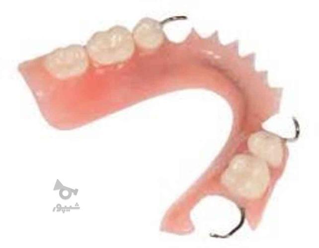 دندان سازی با پذیرش بیمه با ضمانت ( دندان مصنوعی )