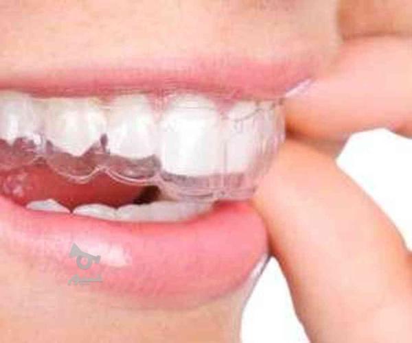 دندان سازی شرق ( دندانسازی ) دندان مصنوعی با بیمه