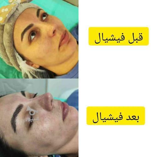 فیشال و پاکسازی پوست