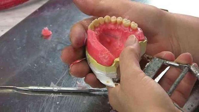 دست دندان کامل و تکه ای ( دندانسازی ) رفع لقی دندان