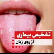 تشخیص بیماریها از روی زبان