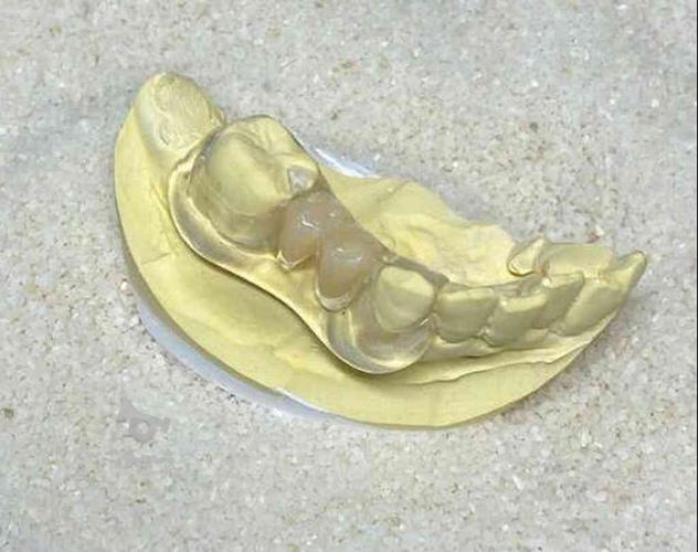 لابراتوار دندانسازی تبریزی