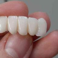 آموزش دندانسازی