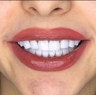 دندانسازی دندان پزشکی