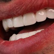 دندانسازی و پزشکی