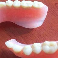 کلینیک دندانسازان حرفه ای پلاک دندان مصنوعی پروتز اوور دنچر