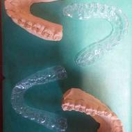 نایتگارد درمان دندان قروچه هوم بلیچ بیلیچینگ سفیدو جرمگیری