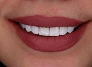 دندانپزشکی زیبایی-خدمات درمانی-زیبایی با شرایط اقساطی