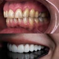 دندانسازی و خدمات دندانپزشکی _ زیبایی