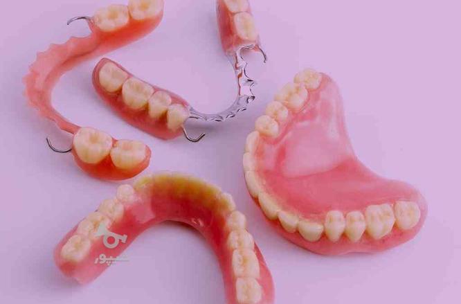 دندانسازی بختیاری (ساخت دست دندان بابیمه) دندان مصنوعی