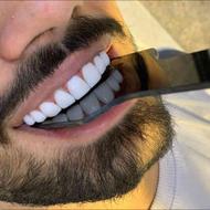 دندانپزشکی و دندانسازی کامپوزیت عصب کشی ترمیم روکش دندان