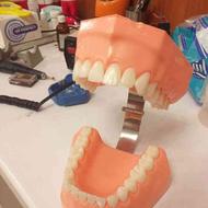 دندانسازی فوق تخصصی‌ خدمات در محل قالبگیری ساخت تعمیر ترمیم