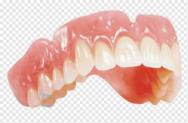 پروتز دندانسازی ساخت دندان مصنوعی متحرک در گروه خرید و فروش خدمات و کسب و کار در البرز در شیپور-عکس1