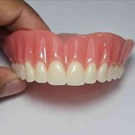 دندانسازی طرح لمینت