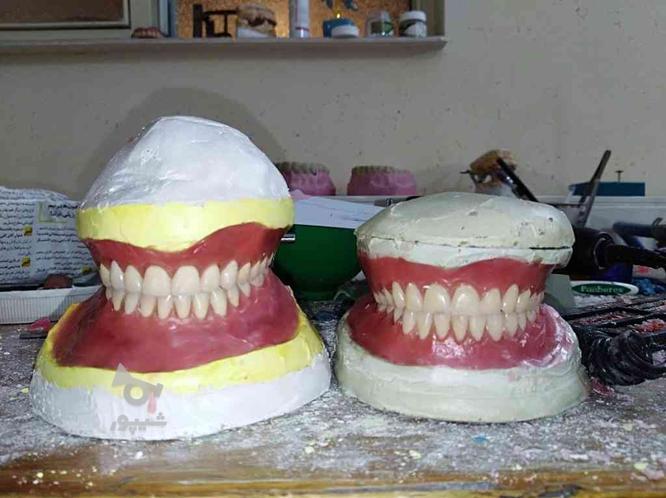 دندانسازی برای افراد کم توان