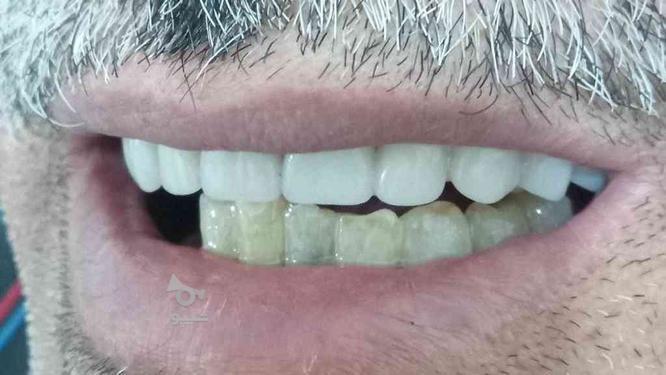 دندانسازی در محل در گروه خرید و فروش خدمات و کسب و کار در خراسان رضوی در شیپور-عکس1