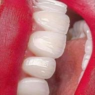 دندانپزشکی با شرایط اقساطی