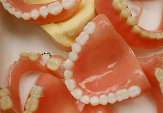 دندان سازی شرق ( دندانسازی ) دندان مصنوعی با بیمه ...