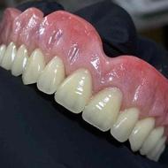 دندانسازی ( دندان مصنوعی)