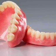 ساخت دندان مصنوعی در دو روز