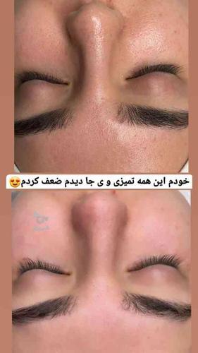 پاکسازی پوست و سلامت مو