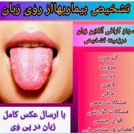 تشخیص و درمان بیماری از روی زبان