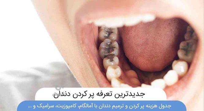 پرکردن دندان ها با قیمت 280 دولتی کوت عبدالله  در گروه خرید و فروش خدمات و کسب و کار در خوزستان در شیپور-عکس1