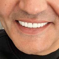 کوره دندانسازی و دندانپزشکی