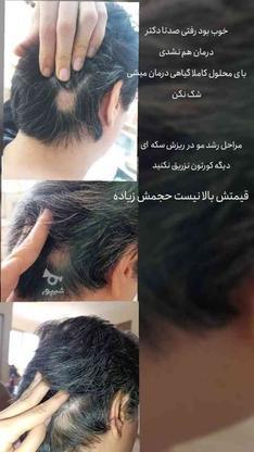 تونیک رشد مجدد موی مایانا در گروه خرید و فروش لوازم شخصی در تهران در شیپور-عکس1