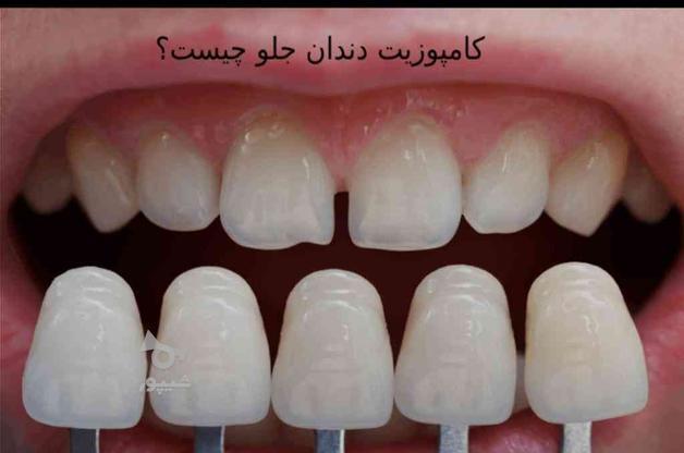 اموزش دستیاری دندانپزشکی در گروه خرید و فروش خدمات و کسب و کار در تهران در شیپور-عکس1