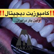 کامپوزیت دندان دیجیتال / خدمات دندانپزشکی روکش لمینت