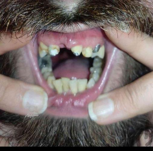 دندانسازی و دندانپزشکی